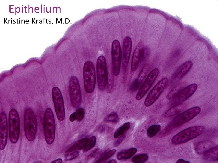 Epithelium Kristine Krafts, M. D. 