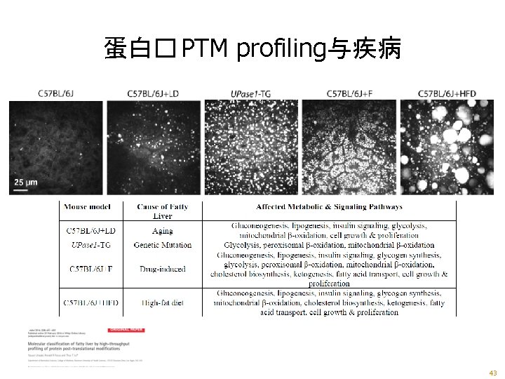 蛋白� PTM profiling与疾病 43 