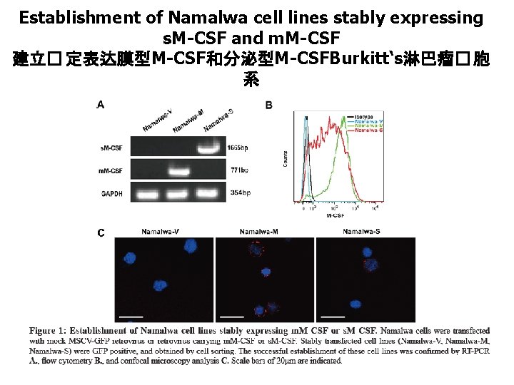 Establishment of Namalwa cell lines stably expressing s. M-CSF and m. M-CSF 建立� 定表达膜型M-CSF和分泌型M-CSFBurkitt‘s淋巴瘤�