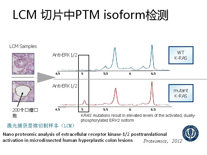 LCM 切片中PTM isoform检测 LCM Samples WT K-RAS Anti-ERK 1/2 4. 5 5 5. 5