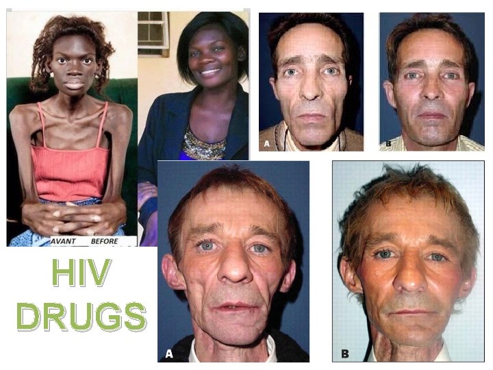 HIV DRUGS 