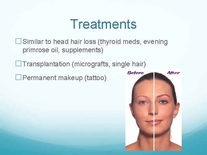 Treatments �Similar to head hair loss (thyroid meds, evening primrose oil, supplements) �Transplantation (micrografts,