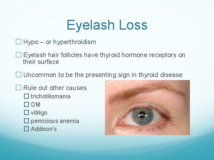 Eyelash Loss � Hypo – or hyperthroidism � Eyelash hair follicles have thyroid hormone
