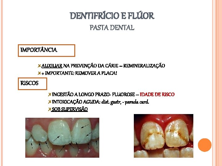 DENTIFRÍCIO E FLÚOR PASTA DENTAL IMPORT NCIA AUXILIAR NA PREVENÇÃO DA CÁRIE – REMINERALIZAÇÃO