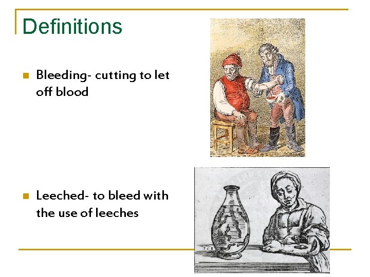 Definitions n Bleeding- cutting to let off blood n Leeched- to bleed with the