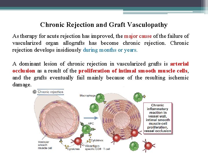 Chronic Rejection and Graft Vasculopathy As therapy for acute rejection has improved, the major
