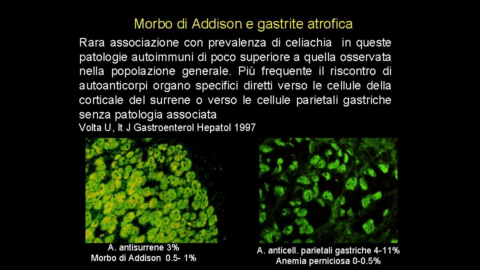 Morbo di Addison e gastrite atrofica Rara associazione con prevalenza di celiachia in queste