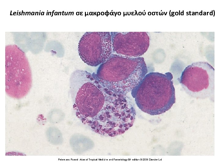 Leishmania infantum σε μακροφάγο μυελού οστών (gold standard) 