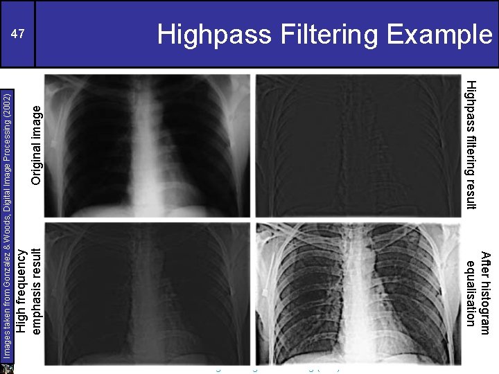 Original image Highpass filtering result After histogram equalisation High frequency emphasis result Images taken