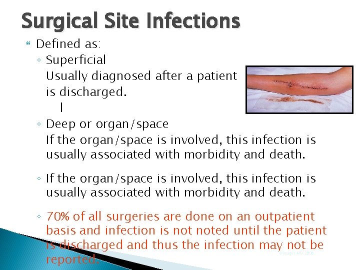 Surgical Site Infections Defined as: ◦ Superficial Usually diagnosed after a patient is discharged. Surgical Site Infections Defined as: ◦ Superficial Usually diagnosed after a patient is discharged.