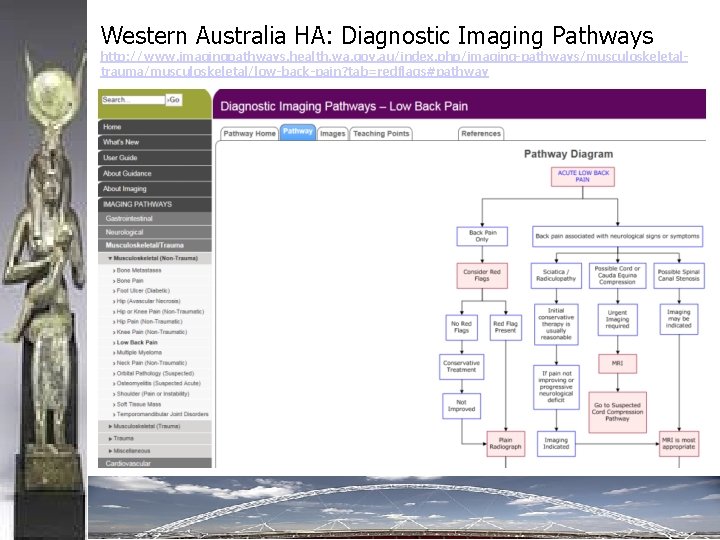 Western Australia HA: Diagnostic Imaging Pathways http: //www. imagingpathways. health. wa. gov. au/index. php/imaging-pathways/musculoskeletaltrauma/musculoskeletal/low-back-pain?