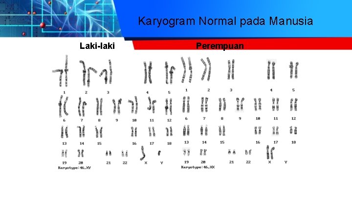 Karyogram Normal pada Manusia Laki-laki Perempuan 