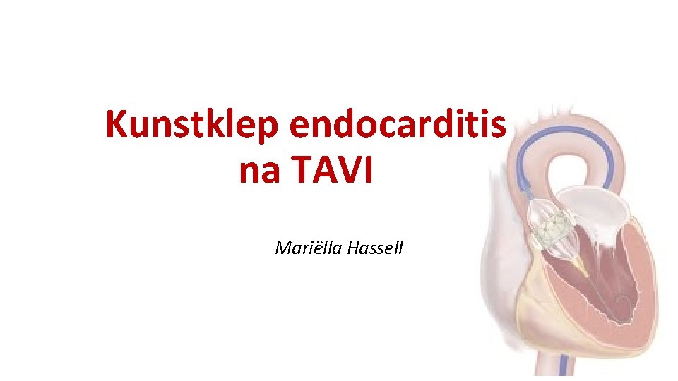 Kunstklep endocarditis na TAVI Mariëlla Hassell 