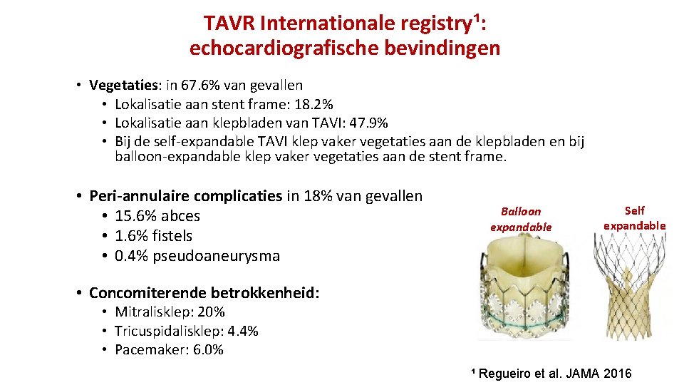 TAVR Internationale registry¹: echocardiografische bevindingen • Vegetaties: in 67. 6% van gevallen • Lokalisatie