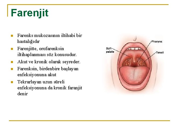 Farenjit n n n Farenks mukozasının iltihabi bir hastalığıdır Farenjitte, orofarenksin iltihaplanması söz konusudur.