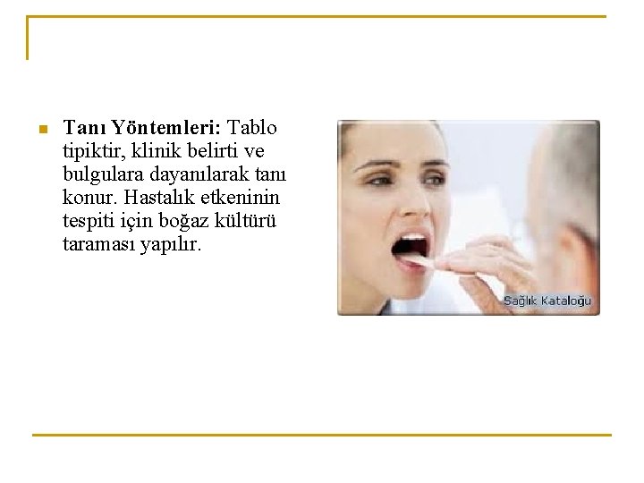 n Tanı Yöntemleri: Tablo tipiktir, klinik belirti ve bulgulara dayanılarak tanı konur. Hastalık etkeninin