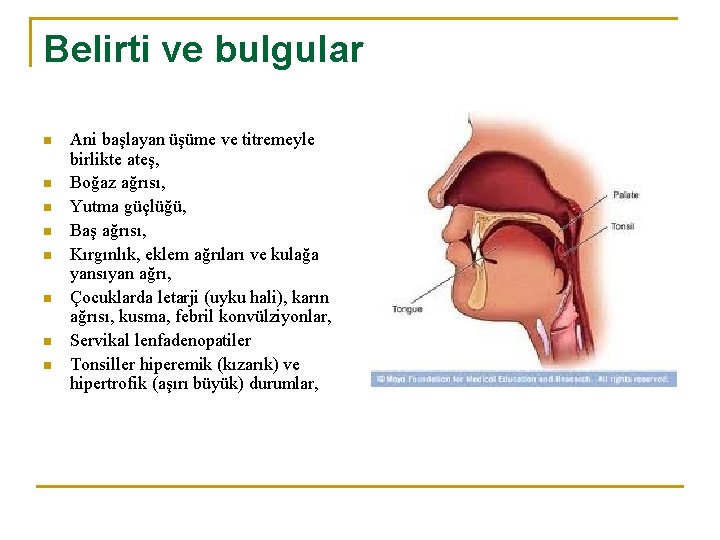 Belirti ve bulgular n n n n Ani başlayan üşüme ve titremeyle birlikte ateş,