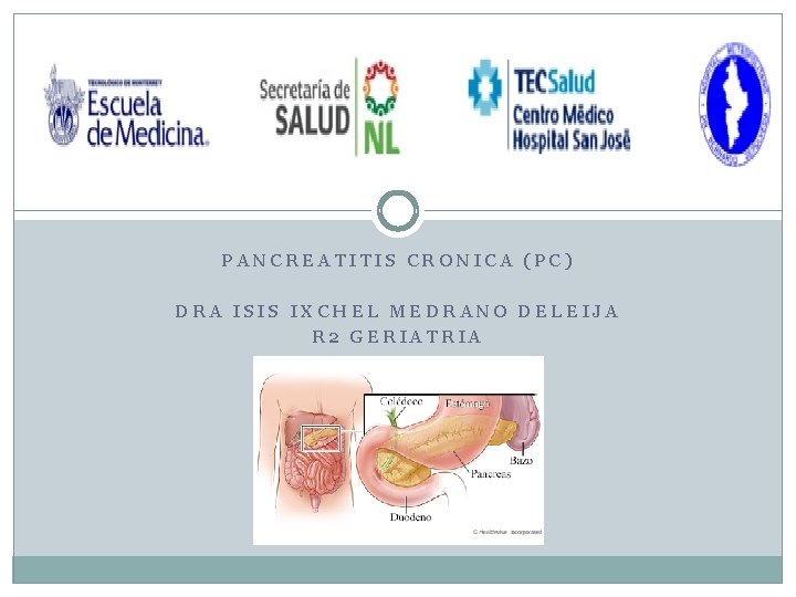 PANCREATITIS CRONICA (PC) DRA ISIS IXCHEL MEDRANO DELEIJA R 2 GERIATRIA 