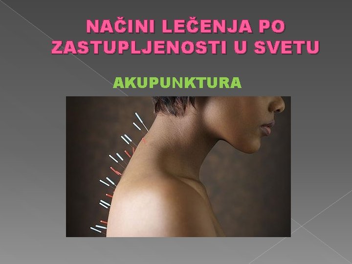 NAČINI LEČENJA PO ZASTUPLJENOSTI U SVETU AKUPUNKTURA 