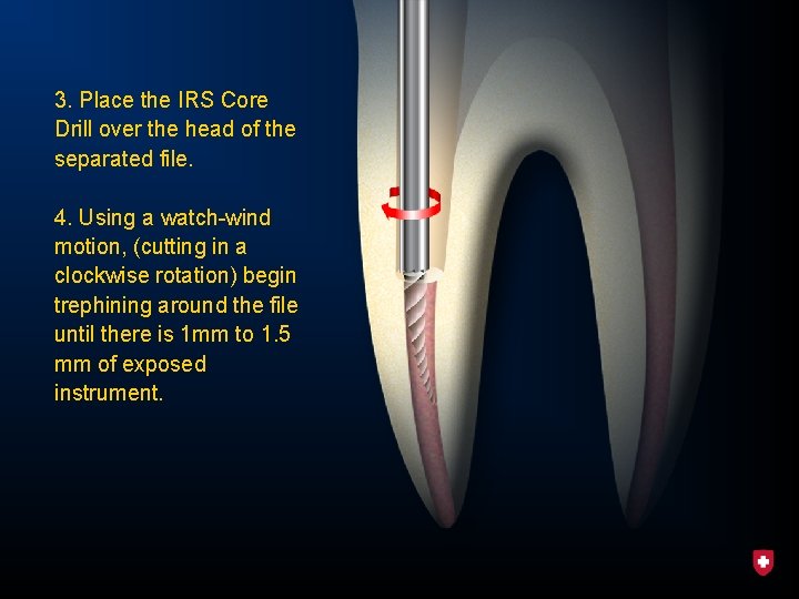 3. Place the IRS Core Drill over the head of the separated file. 4.