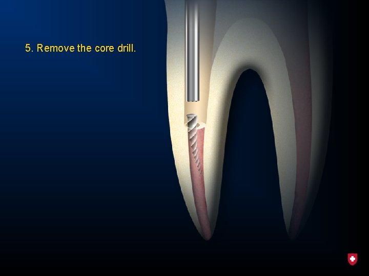 5. Remove the core drill. 