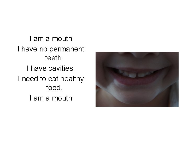 I am a mouth I have no permanent teeth. I have cavities. I need