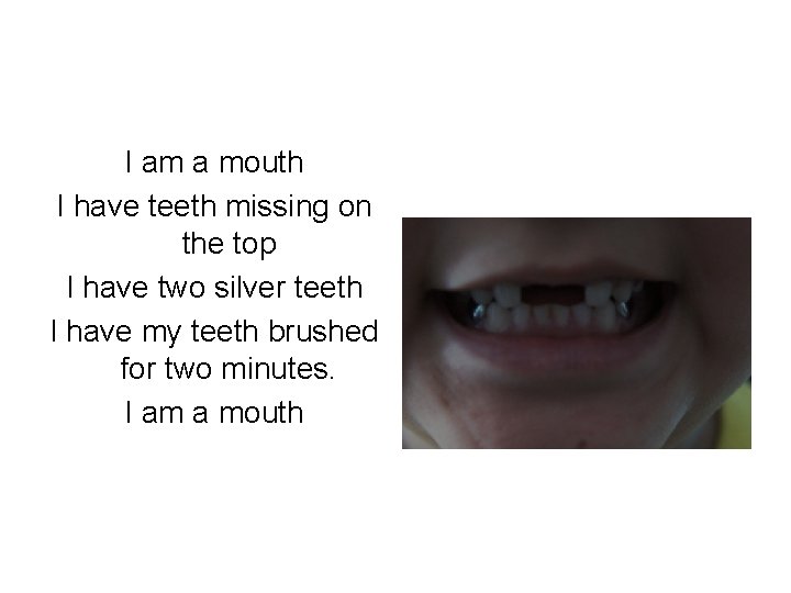 I am a mouth I have teeth missing on the top I have two