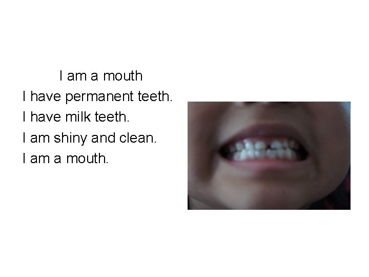 I am a mouth I have permanent teeth. I have milk teeth. I am