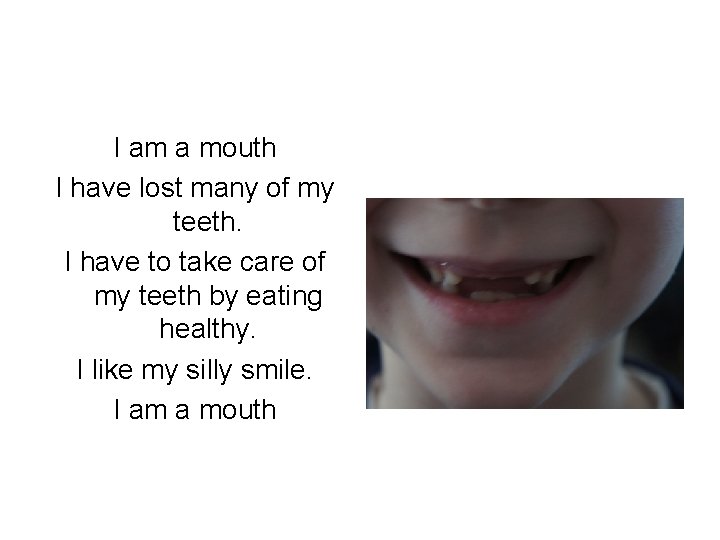 I am a mouth I have lost many of my teeth. I have to