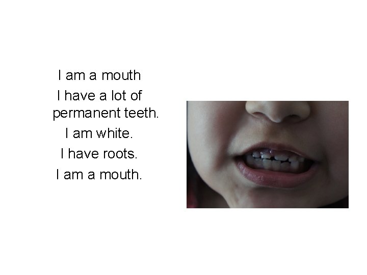 I am a mouth I have a lot of permanent teeth. I am white.
