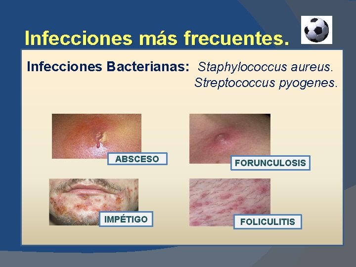 Infecciones más frecuentes. Infecciones Bacterianas: Staphylococcus aureus. Streptococcus pyogenes. ABSCESO IMPÉTIGO FORUNCULOSIS FOLICULITIS 