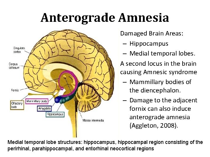 Anterograde Amnesia • Damaged Brain Areas: – Hippocampus – Medial temporal lobes. • A