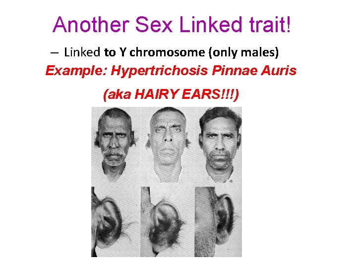 Another Sex Linked trait! – Linked to Y chromosome (only males) Example: Hypertrichosis Pinnae
