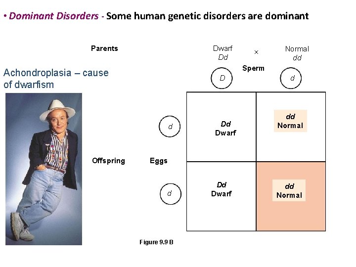  • Dominant Disorders - Some human genetic disorders are dominant Parents Dwarf Dd