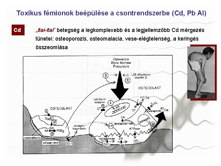 Toxikus fémionok beépülése a csontrendszerbe (Cd, Cd Pb Al) Cd „itai-itai” betegség a legkomplexebb