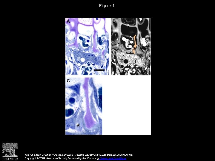 Figure 1 The American Journal of Pathology 2009 1752668 -2675 DOI: (10. 2353/ajpath. 2009.