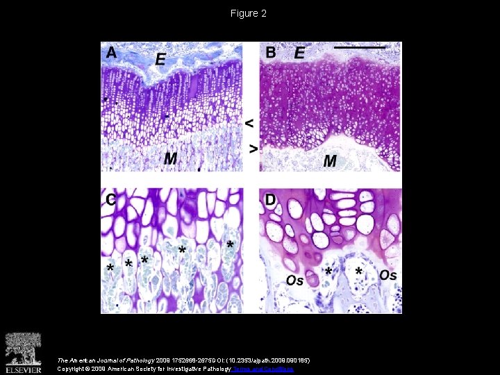 Figure 2 The American Journal of Pathology 2009 1752668 -2675 DOI: (10. 2353/ajpath. 2009.