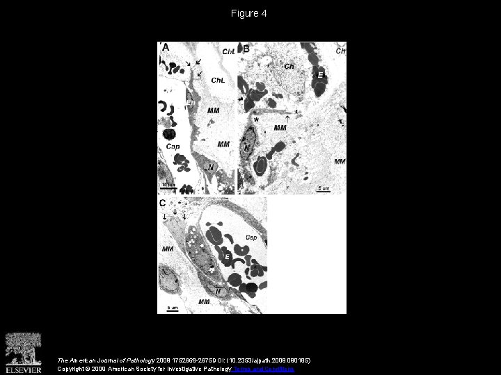 Figure 4 The American Journal of Pathology 2009 1752668 -2675 DOI: (10. 2353/ajpath. 2009.