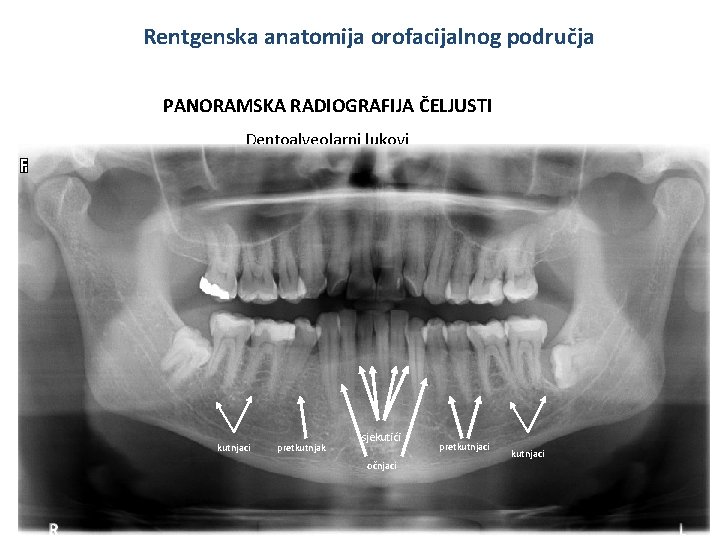Rentgenska anatomija orofacijalnog područja PANORAMSKA RADIOGRAFIJA ČELJUSTI Dentoalveolarni lukovi kutnjaci pretkutnjak sjekutići očnjaci pretkutnjaci