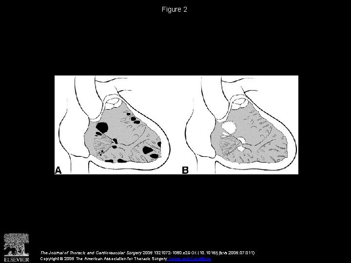 Figure 2 The Journal of Thoracic and Cardiovascular Surgery 2006 1321072 -1080. e 2