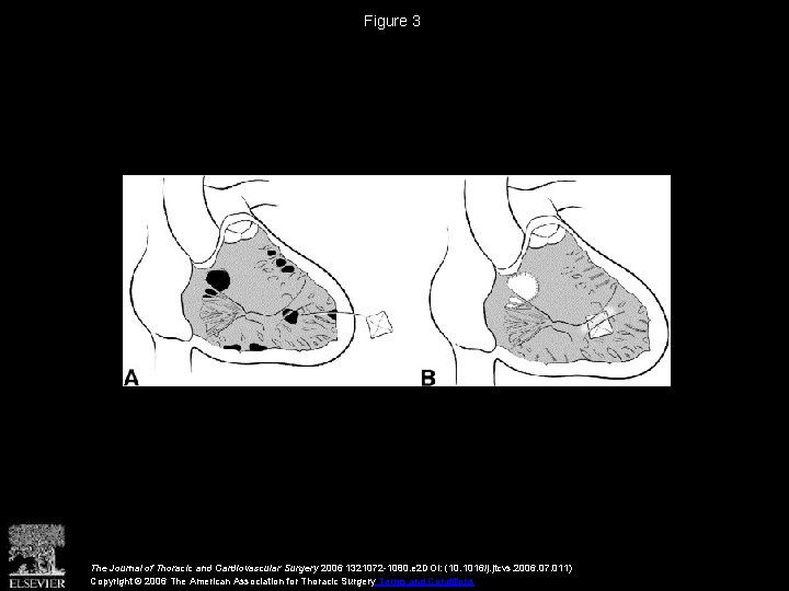 Figure 3 The Journal of Thoracic and Cardiovascular Surgery 2006 1321072 -1080. e 2