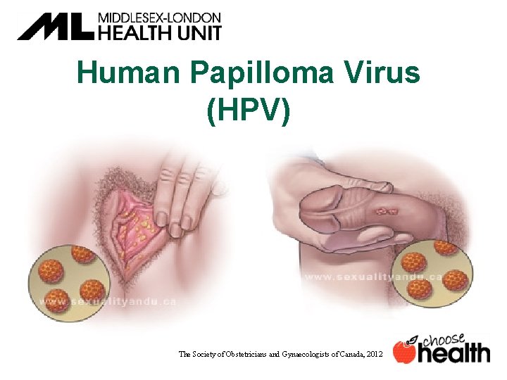 Human Papilloma Virus (HPV) The Society of Obstetricians and Gynaecologists of Canada, 2012 