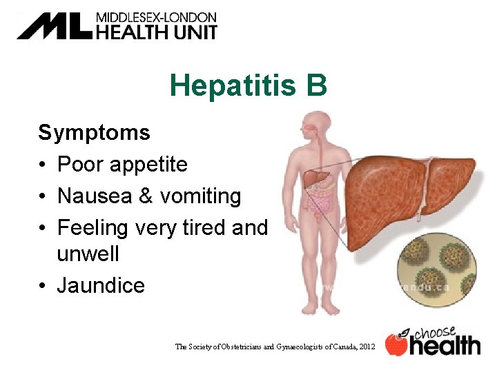 Hepatitis B Symptoms • Poor appetite • Nausea & vomiting • Feeling very tired