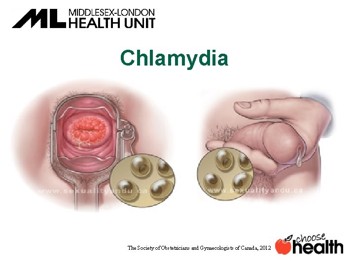 Chlamydia The Society of Obstetricians and Gynaecologists of Canada, 2012 