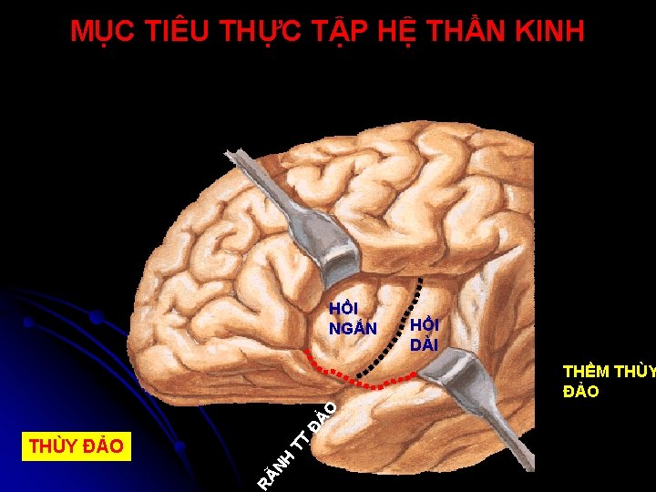 MỤC TIÊU THỰC TẬP HỆ THẦN KINH HỒI NGẮN HỒI DÀI NH RÃ THÙY