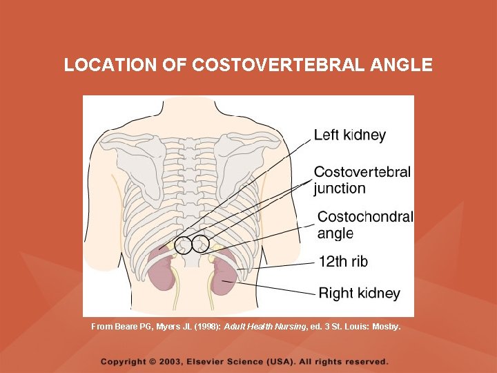 LOCATION OF COSTOVERTEBRAL ANGLE From Beare PG, Myers JL (1998): Adult Health Nursing, ed.
