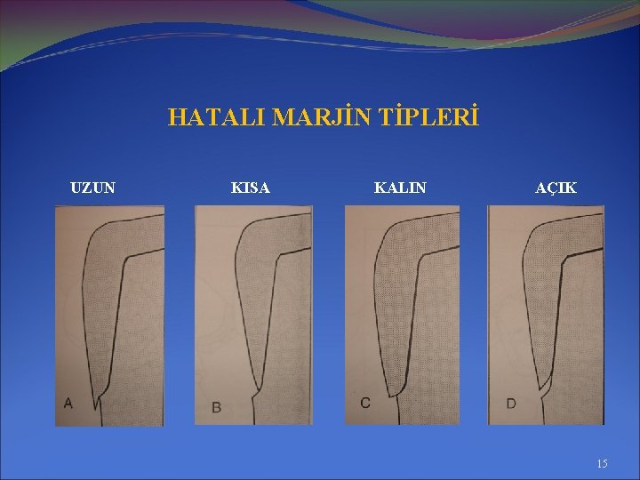 HATALI MARJİN TİPLERİ UZUN KISA KALIN AÇIK 15 