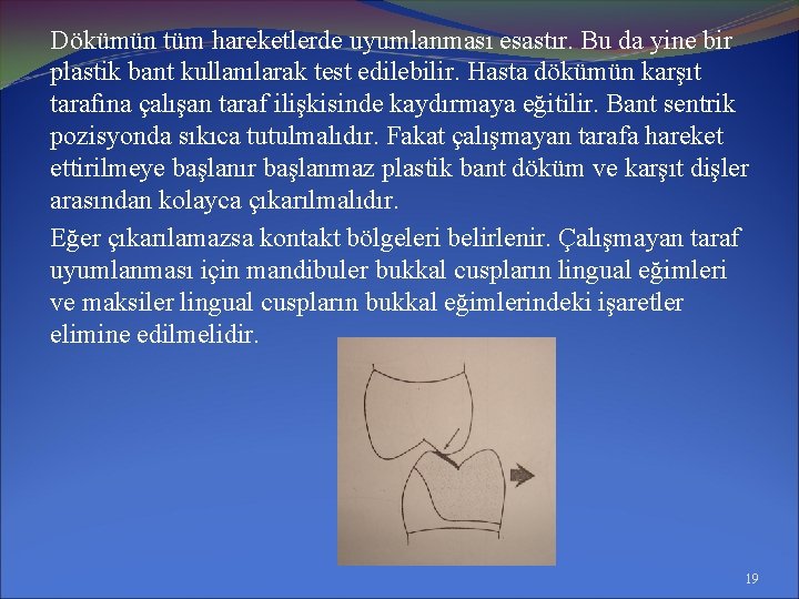 Dökümün tüm hareketlerde uyumlanması esastır. Bu da yine bir plastik bant kullanılarak test edilebilir.