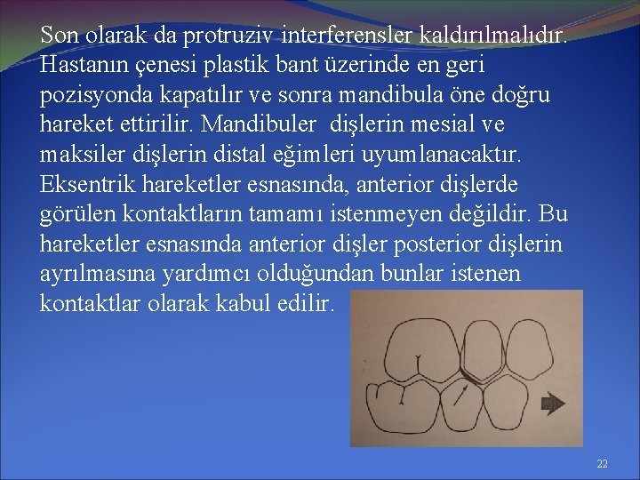 Son olarak da protruziv interferensler kaldırılmalıdır. Hastanın çenesi plastik bant üzerinde en geri pozisyonda