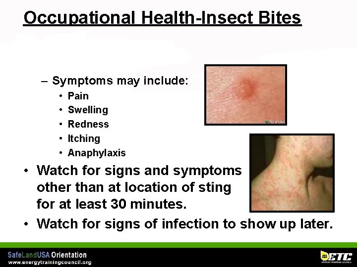 Occupational Health-Insect Bites – Symptoms may include: • • • Pain Swelling Redness Itching